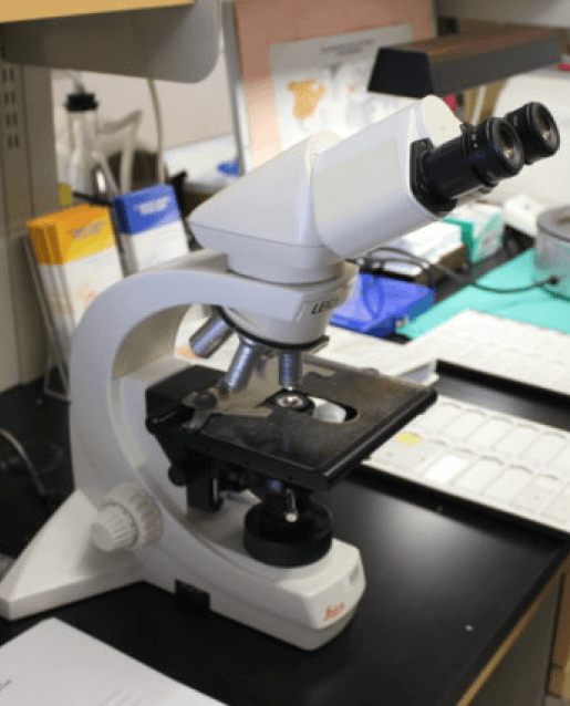 Brain trumour tissue sample placed under a microscope